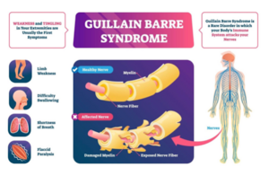Guillain-Barre.png