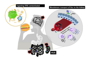 Hemolytic-uremic-syndrome-HUS.png Hemolytic-uremic-syndrome-HUS.png