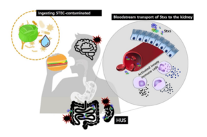 Hemolytic-uremic-syndrome-HUS.png