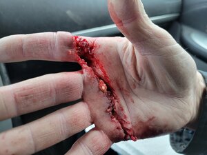 My hand1.jpg My hand1.jpg