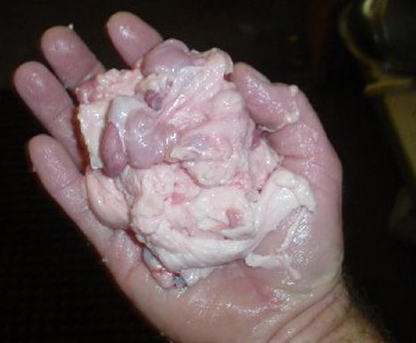 Gland3.jpg